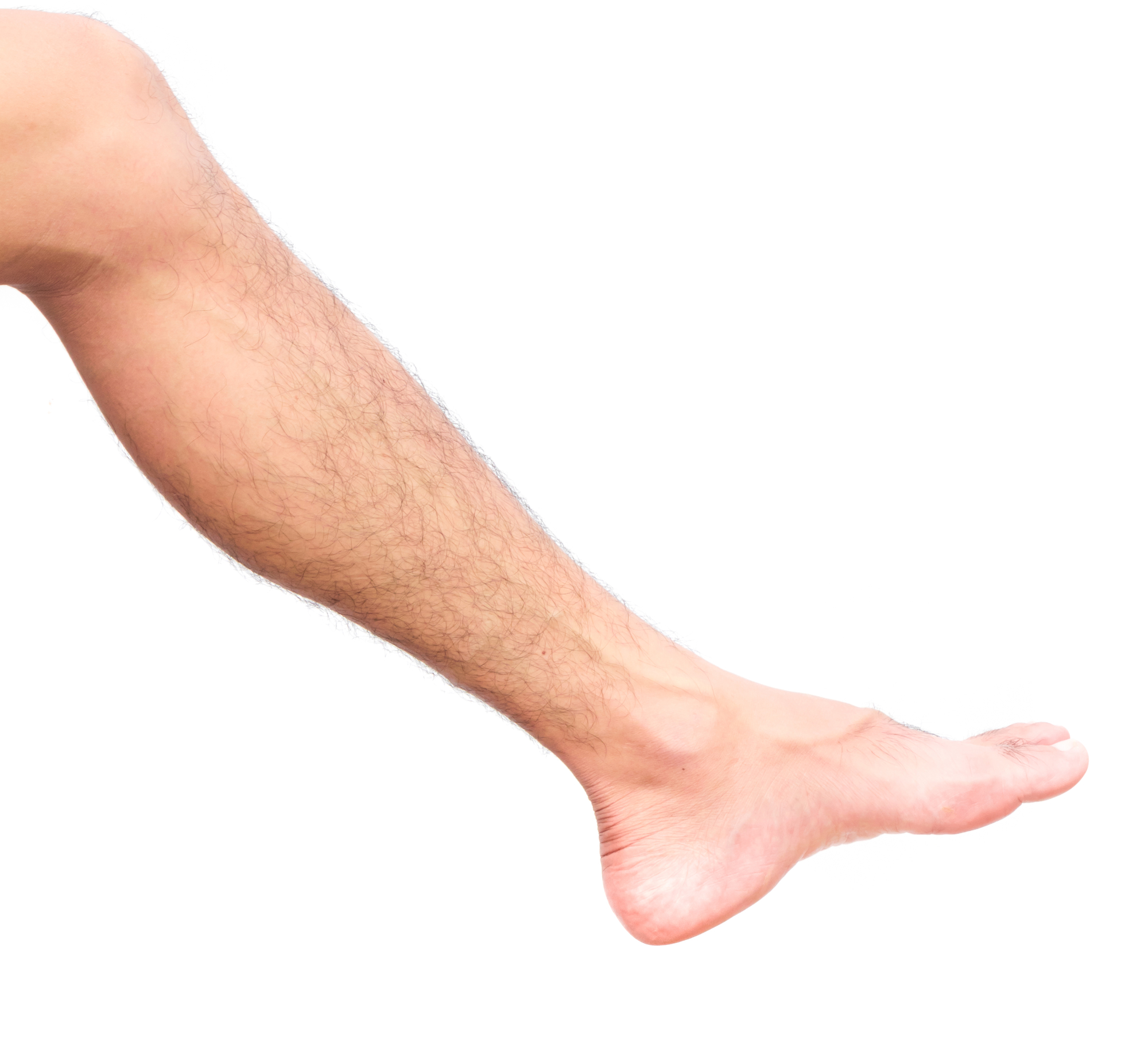 Hair Loss On Your Legs You Might Have A Vascular Problem