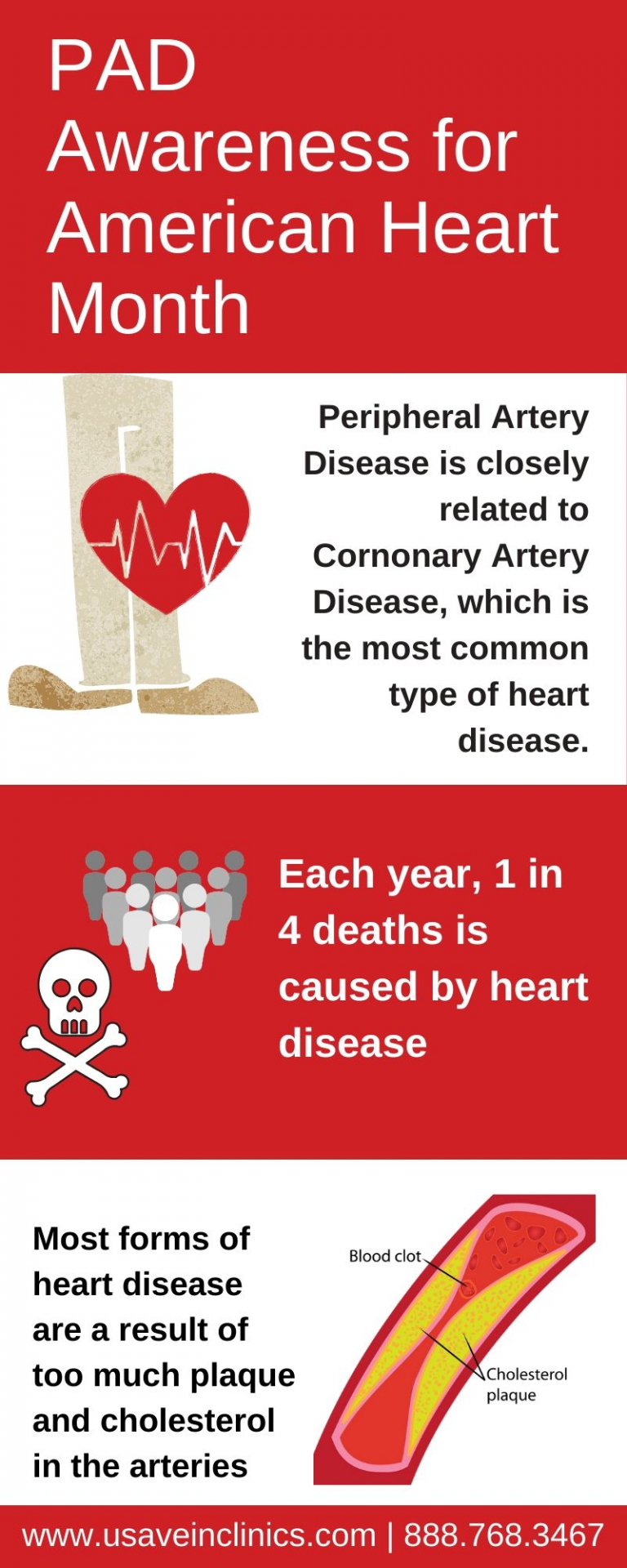 American Heart Month | Fight off PAD and Heart Disease