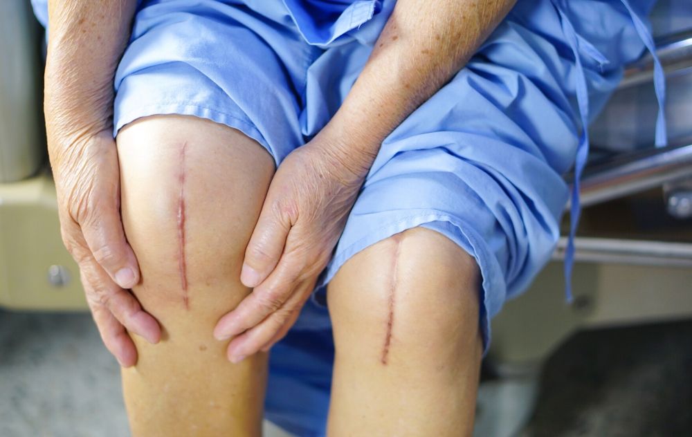 Scar Tissue 101 - How Scar Tissue Affects the Body