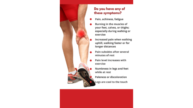 why-are-my-legs-tingling-after-walking-usa-vascular-centers